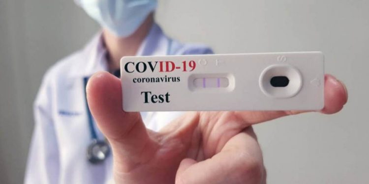 La Anmat autorizó el uso de quinto test de autoevaluación de coronavirus