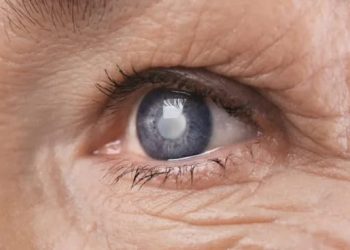 Día Mundial del Glaucoma: ¿por qué se conmemora cada 12 de marzo?